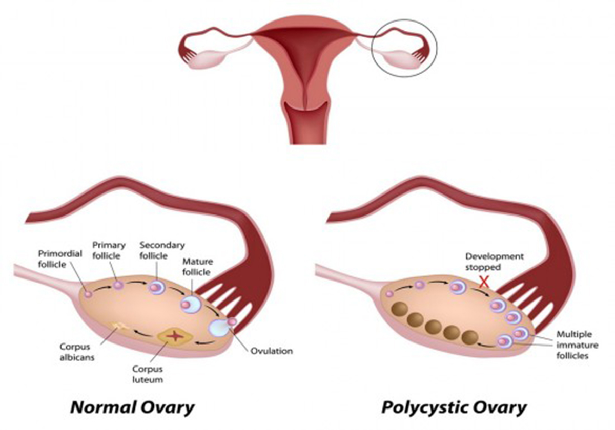 psc-anatomy-and-physiology-2-labeled-ovary-model