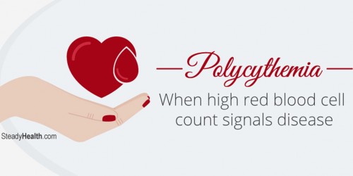 Polycythemia: When High Red Blood Cell Count Signals Disease