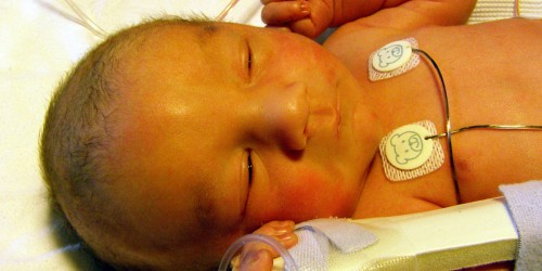 Alagille Syndrome: Causes, Symptoms, Treatment