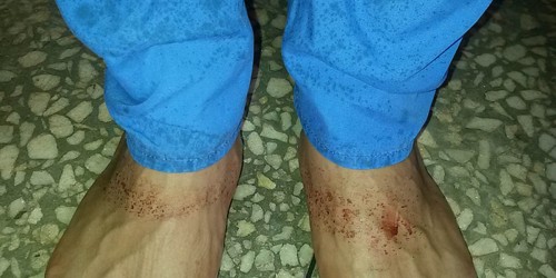 Why Doctors Sometimes Miss An Ectopic Pregnancy, And What To Do About It