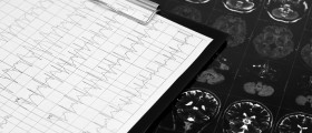 Postural Orthostatic Tachycardia Syndrome (POTS)