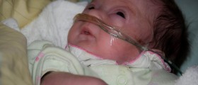 Premature Babies Are Showing Less Interest In Other People