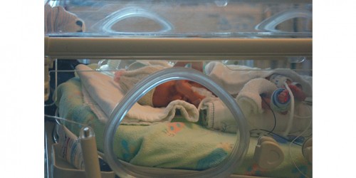 Cancer Drug Avastin Could Prevent Blindness in Premature Babies