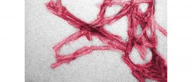 Prions Similar To The Proteins That Cause Mad-Cow Disease May Be Essential In Brain Development