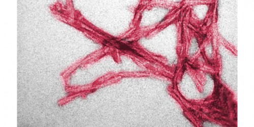 Prions Similar To The Proteins That Cause Mad-Cow Disease May Be Essential In Brain Development