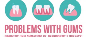 Problems With Gums: Gingivitis (Gum Inflammation) vs. Periodontitis (Gum Disease)