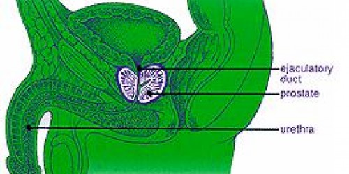 How to treat prostatitis with natural supplements?