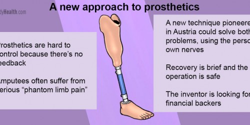 The World's First Artificial Limb (That's Really A Limb)