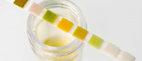 Protein in urine: Causes & Risk factors