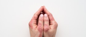 Psoriasis Awareness Month: Psoriasis Treatment For The 21st Century