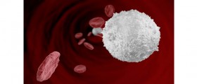 What does high white blood cells count indicate?