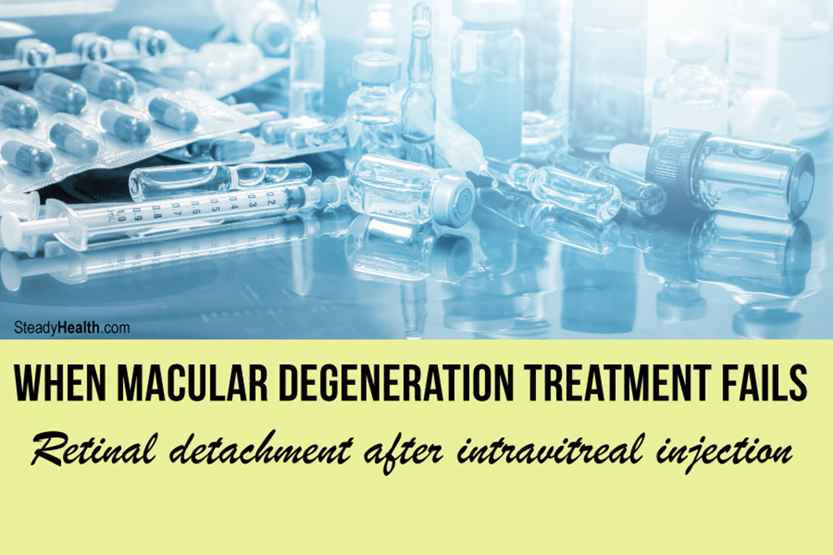 Retinal Detachment after Intravitreal Injection: When Macular ...