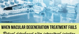 Retinal Detachment after Intravitreal Injection: When Macular Degeneration Treatment Fails