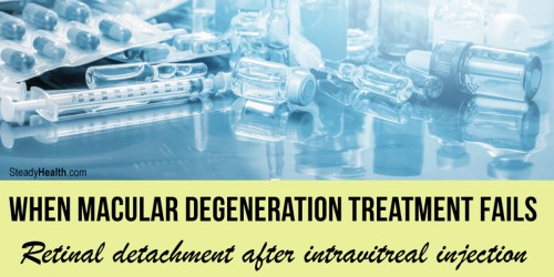 Retinal Detachment after Intravitreal Injection: When Macular Degeneration Treatment Fails