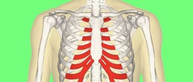 Costochondritis