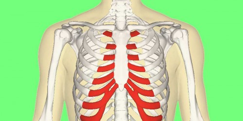 Costochondritis