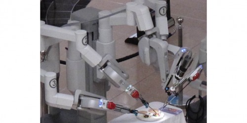 Da Vinci Robotic Surgery: Pros and Cons