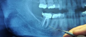 Clinical Skills Essential For The Young Indian Dentist To Survive