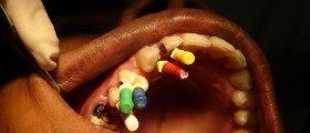 Root Canal Treatment: No Longer The Stuff Of Nightmares