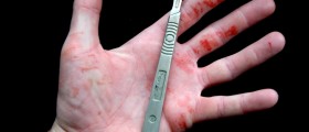 Seven Extreme Cases Of Medical Self-Treatment