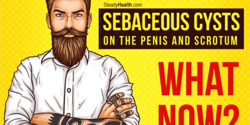 Sebaceous Cysts On The Penis And Scrotum: What Now?