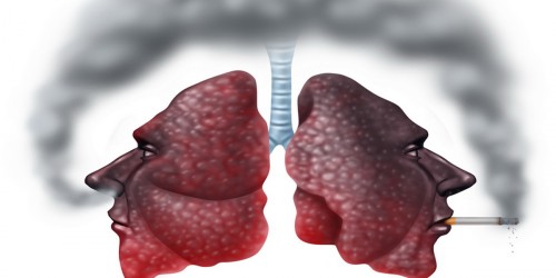 Should We Worry About Third-Hand Smoke?