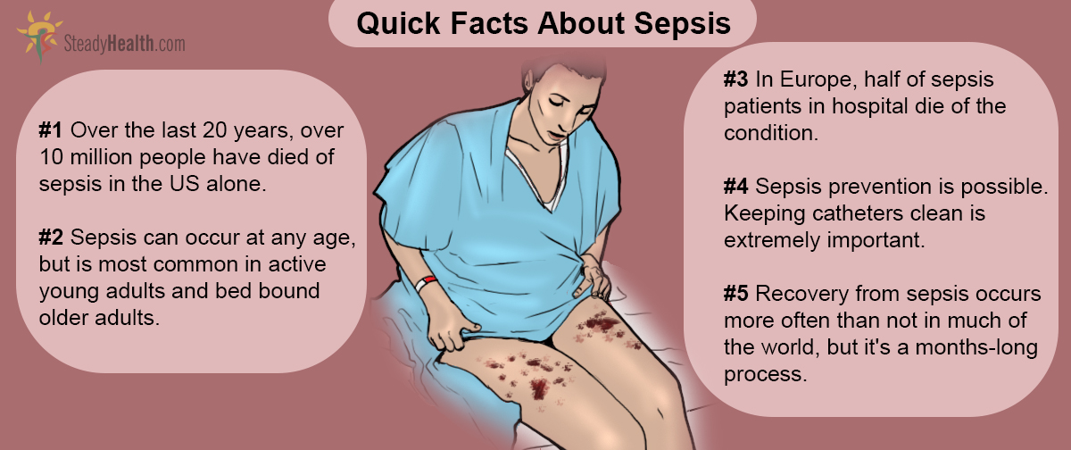 Symptoms sepsis Septicemia