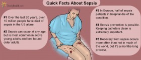 Sepsis: What You Need To Know