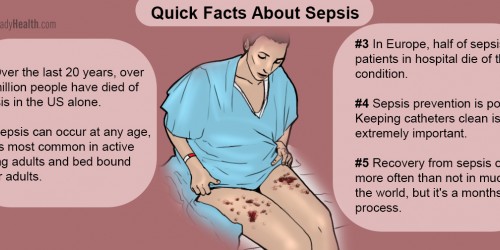 Sepsis: What You Need To Know