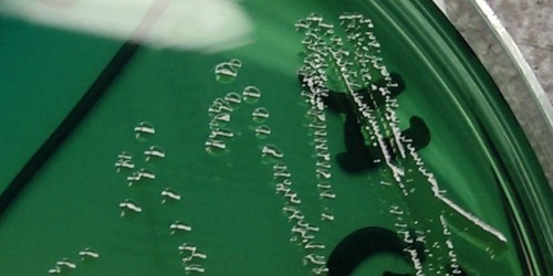 What Is Shigellosis? Basic Info, Symptoms, Diagnosis, Treatment