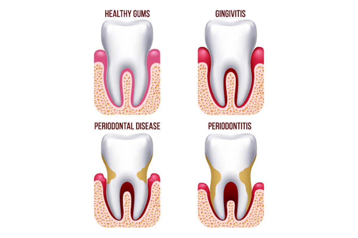 bone age less than chronological age