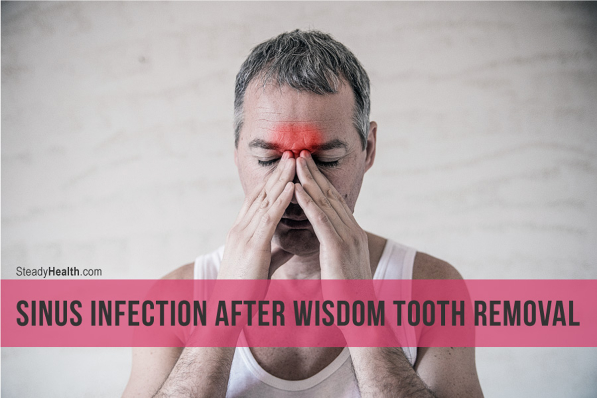 Sinus Infection After Wisdom Tooth Removal | Ear, Nose, Throat, and