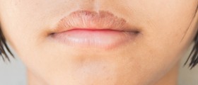 Sjögren’s Syndrome And Multiple Sclerosis: Differences And Similarities