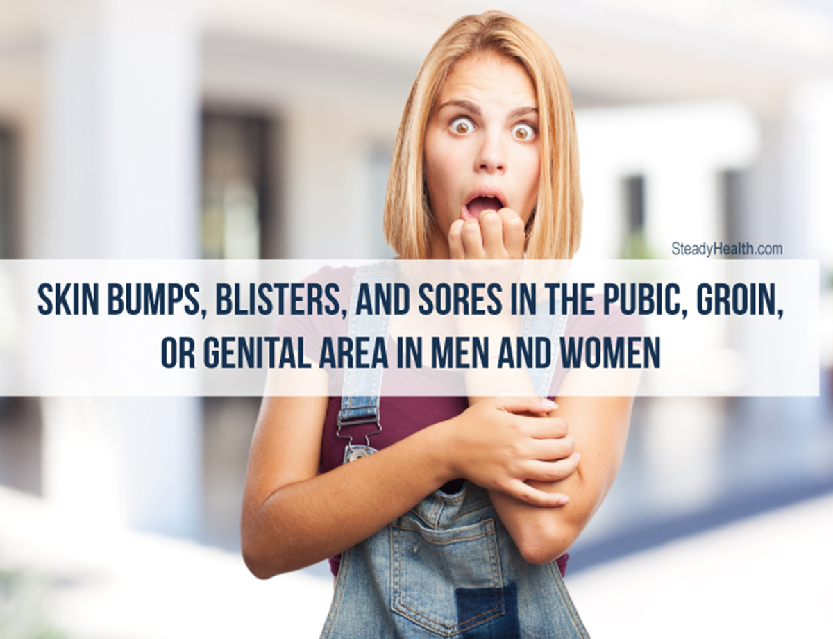 Skin Bumps Blisters And Sores In The Pubic Groin Or Genital Area In Men And Women Skin