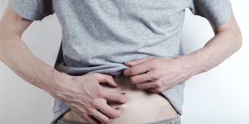 3 проблемы с кожей и сыпь, связанные с гепатитом С