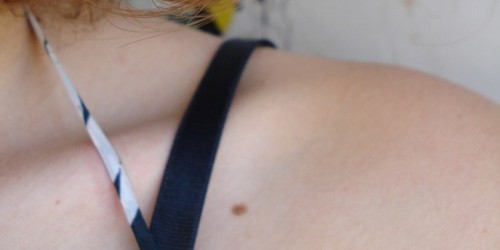 Warning Signs Of Skin Cancer