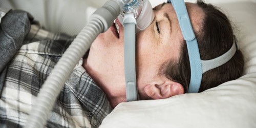 Sleep apnea