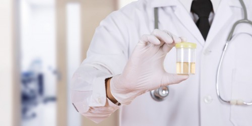 Smelly Or Cloudy Pee: UTI Or Could It Be Something Else?