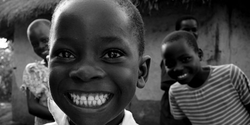 How To Get Whiter Teeth