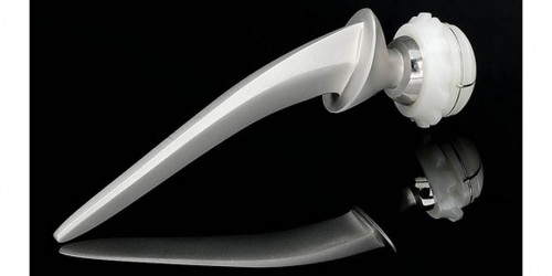 A New Way To Get A New Hip