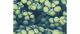 Bullous Impetigo: Skin Disease in Children