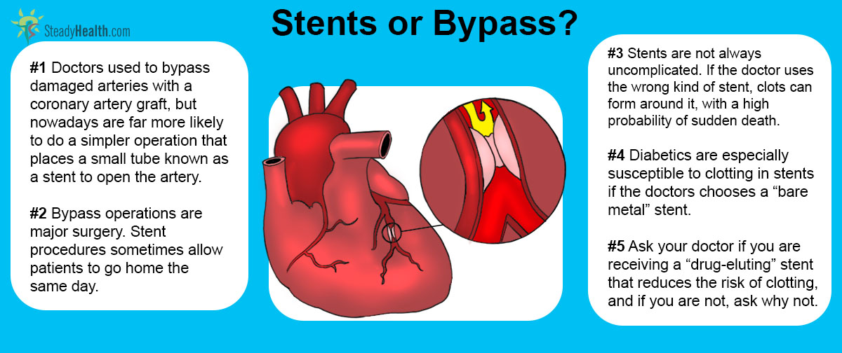 stents-or-bypass-which-is-safer-for-diabetics-lymphatic-endocrine