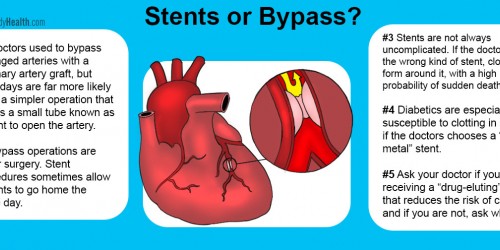 Stents Or Bypass: Which Is Safer For Diabetics?