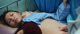 Appendicular Mass: A Dreadful Complication Of Appendicitis