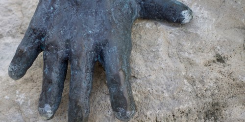 Stone Man Syndrome: What Is Fibrodysplasia Ossificans Progressiva (FOP)?