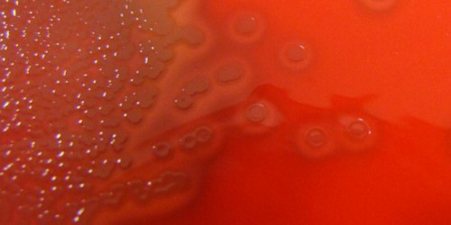 Meningococcal Disease: Meningitis treatment and prevention