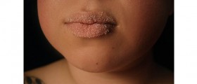 Does Eating Sugar Age Your Skin?