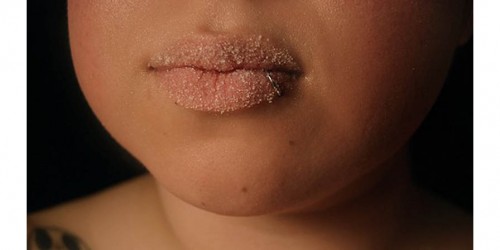 Does Eating Sugar Age Your Skin?