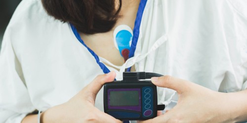 Supraventricular Tachycardia (Arrhythmia): Symptoms, Types, Diagnosis And Treatment For SVT