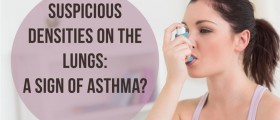Suspicious Densities On The Lungs: A Sign Of Asthma?